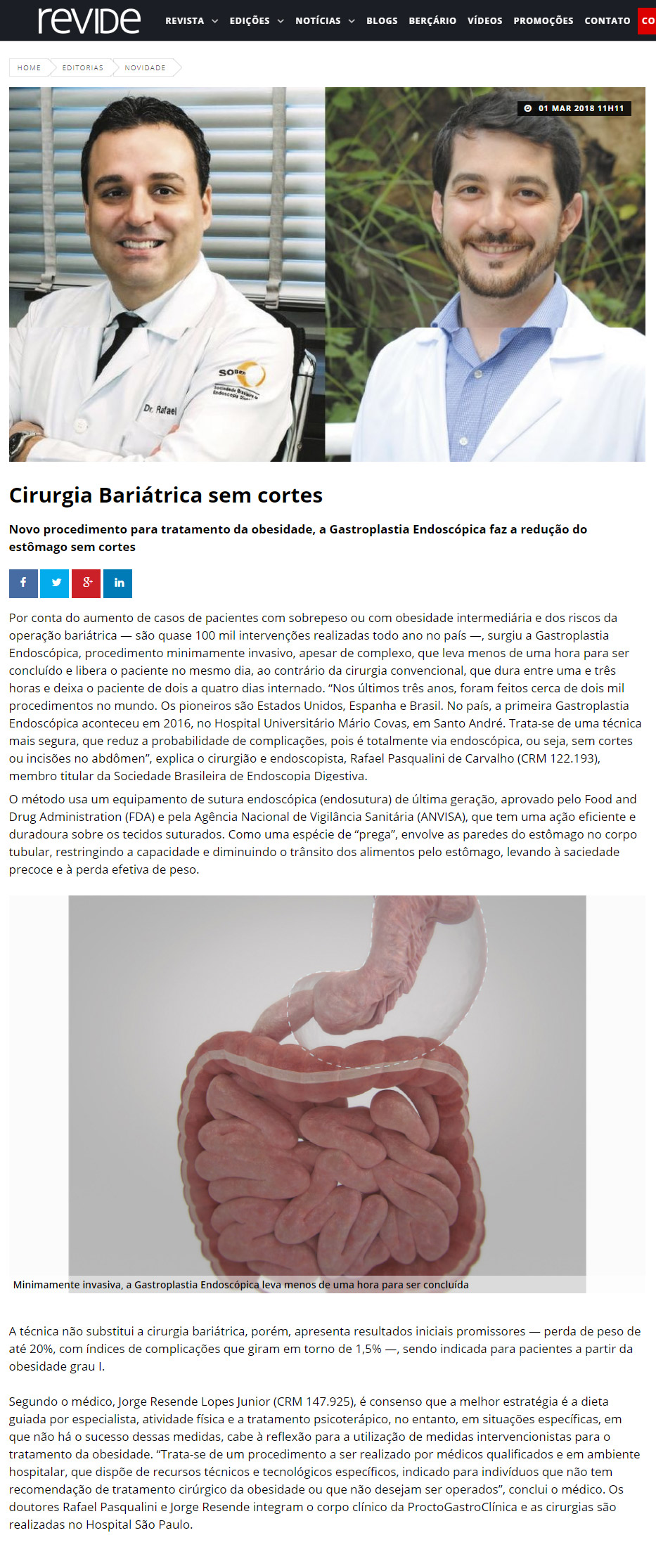 Cirurgia Bariátrica sem cortes Revide Novidade